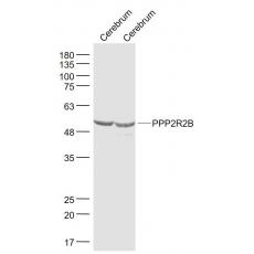 Anti-PPP2R2B/PP2A-B55 antibody
