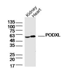 Anti-PODXL antibody