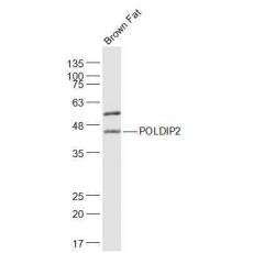 Anti-POLDIP2 antibody