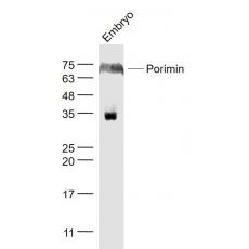 Anti-Porimin antibody