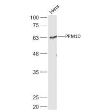 Anti-PPM1D antibody
