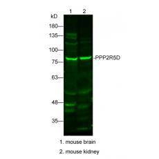 Anti-PPP2R5D antibody