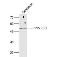 Anti-PPP2R5C antibody