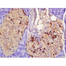 Anti-PRLR antibody