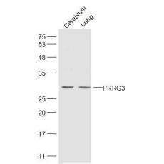Anti-PRRG3 antibody