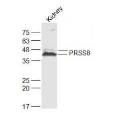 Anti-PRSS8 antibody