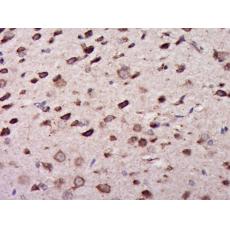 Anti-PPP2R5E antibody