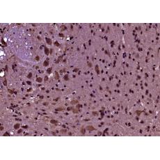 Anti-PRODH antibody