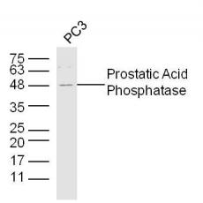 Anti-Prostatic Acid Phosphatase antibody
