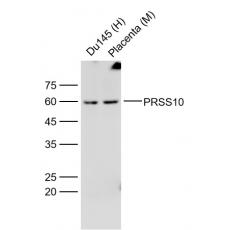 Anti-PRSS10 antibody