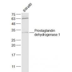 Anti-Prostaglandin dehydrogenase 1 antibody