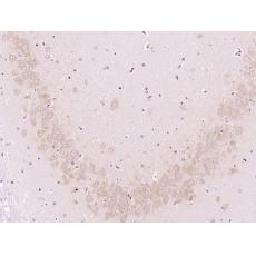 Anti-Protective protein/Cathepsin A antibody