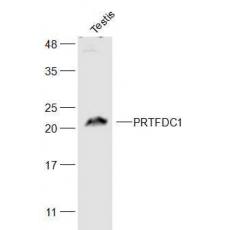 Anti-PRTFDC1 antibody