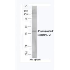 Anti-PTGER2 antibody