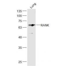 Anti-RANK antibody