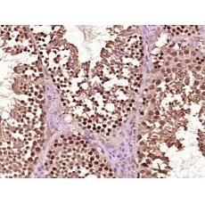 Anti-RAR Beta antibody