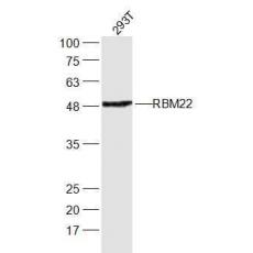 Anti-RBM22 antibody