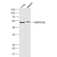 Anti-RBPSUHL antibody