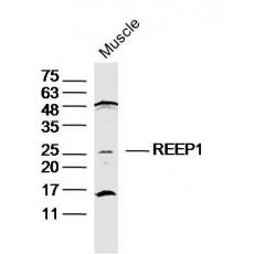 Anti-REEP1 antibody