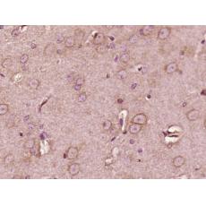 Anti-Regucalcin antibody