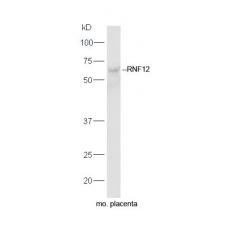 Anti-RNF12 antibody