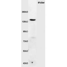 Anti-RNF123 antibody