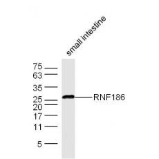 Anti-RNF186 antibody