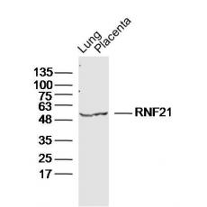 Anti-RNF21 antibody