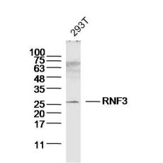 Anti-RNF3 antibody