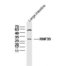 Anti-RNF35 antibody