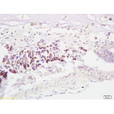 Anti-RNF43 antibody