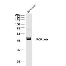 Anti-ROR beta antibody
