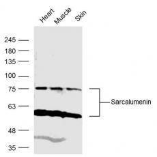 Anti-Sarcalumenin antibody