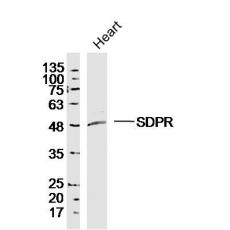 Anti-SDPR antibody