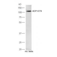 Anti-SCP1/CT8 antibody