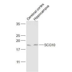 Anti-SCG10 antibody