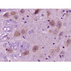 Anti-SCD1 antibody