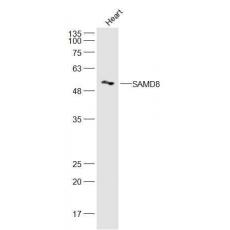 Anti-SAMD8 antibody