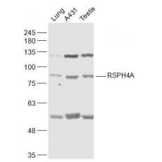 Anti-RSPH4A antibody
