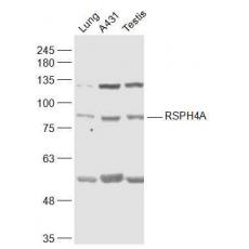 Anti-ROR alpha antibody