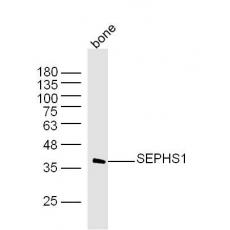 Anti-SEPHS1 antibody