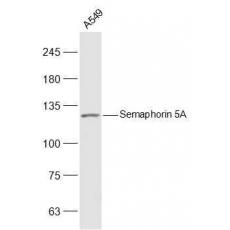 Anti-Semaphorin 5A antibody