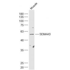 Anti-SEMA4D antibody