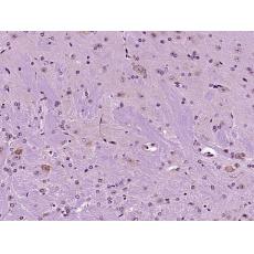 Anti-SCFD2 antibody