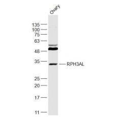 Anti-SAPS3 antibody