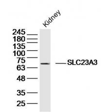 Anti-SLC23A3 antibody