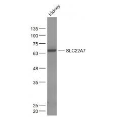 Anti-SLC22A7 antibody