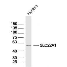Anti-SLC22A1 antibody
