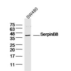 Anti-SerpinB8 antibody