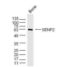 Anti-SENP2 antibody